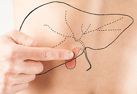 psyllium husk after gallbladder removal